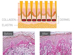 Wound Healing1