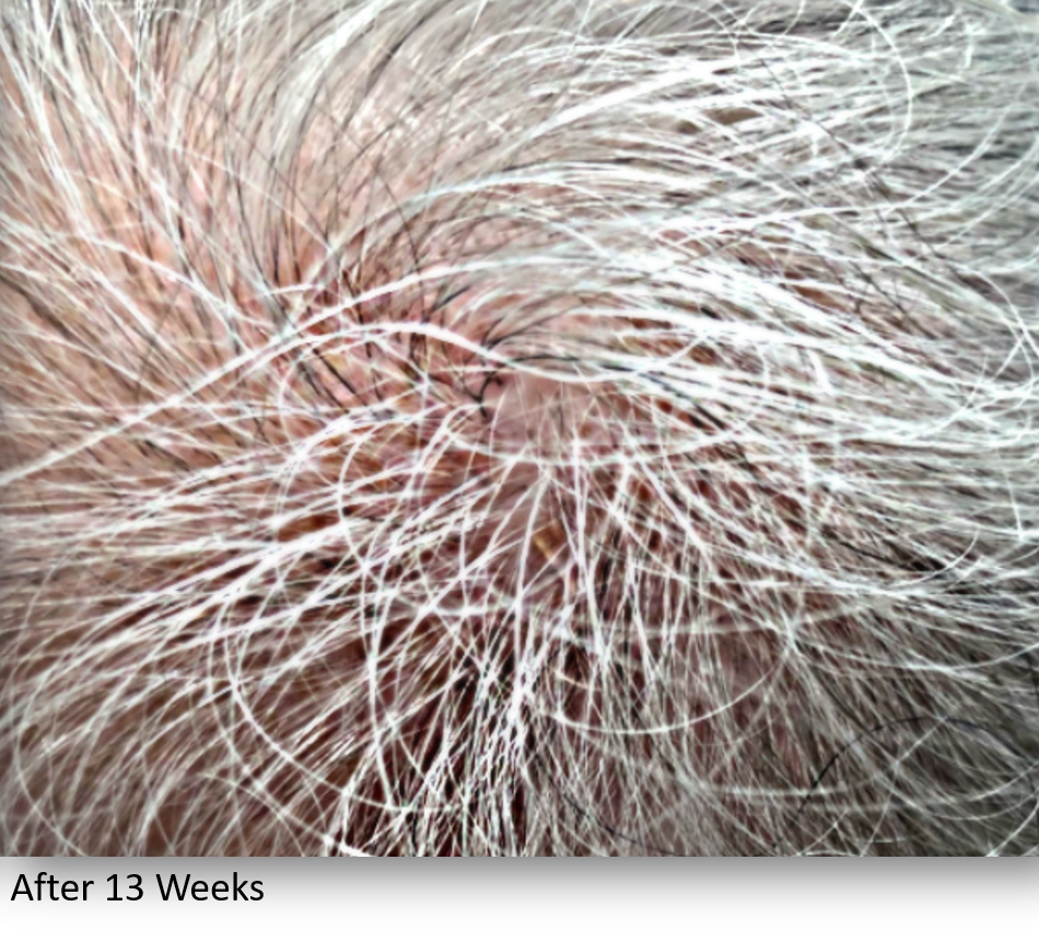 After Image: Keralase - front