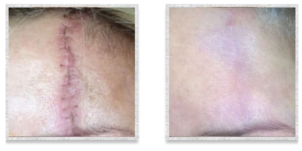 1772095982_venus-viva-large02 venus viva large02