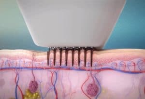 1772095993_VVI_Animation_Skin-Slice02-300x205 1772095993 VVI Animation Skin Slice02 300x205 1