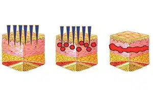Collagen 300x188 1.jpg