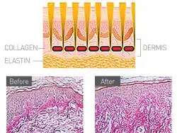 Wound Healing1.jpg 1 1